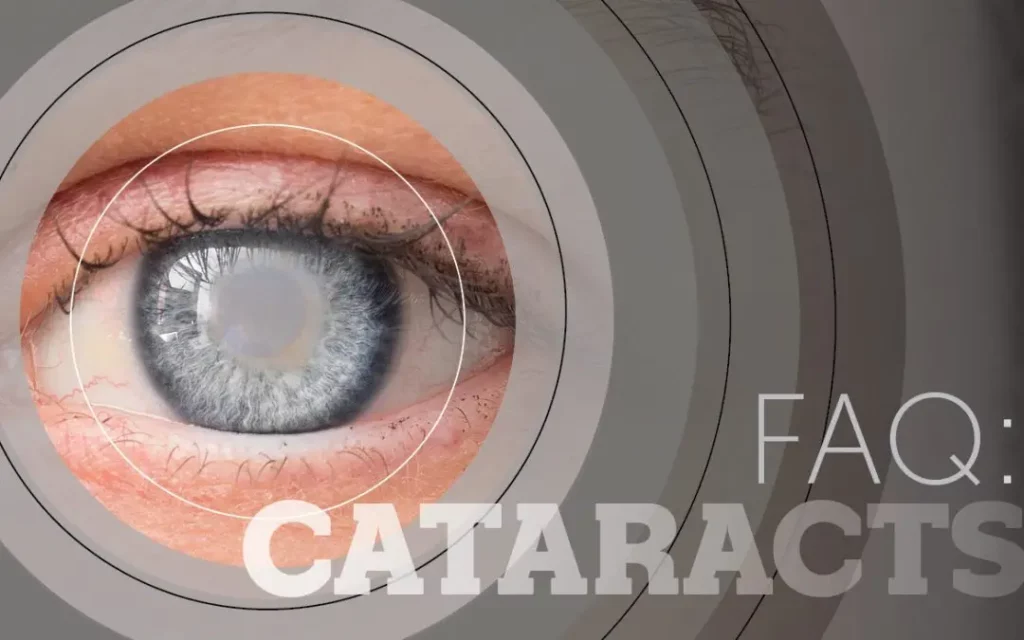 FAQ Cataracts